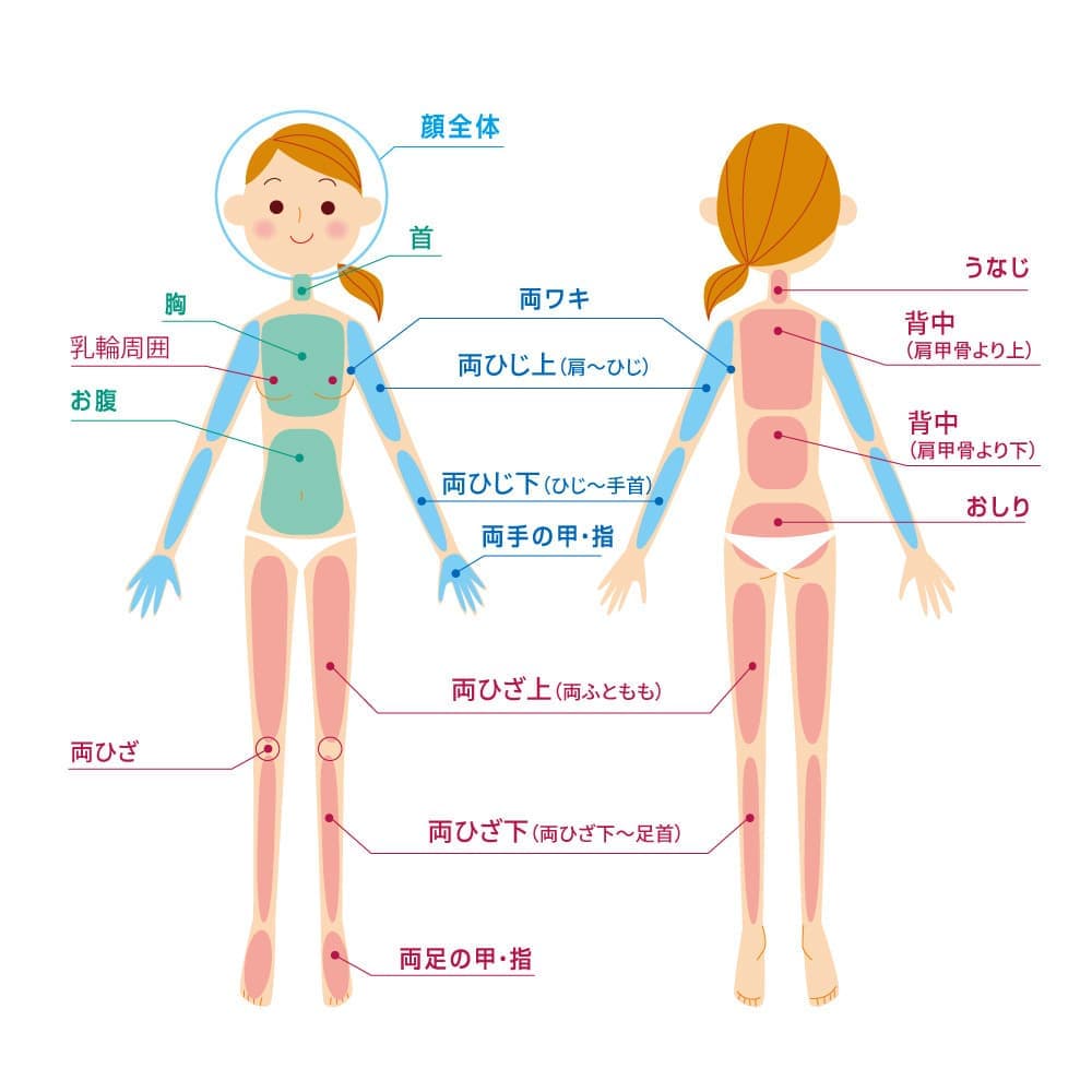 女性脱毛全体図