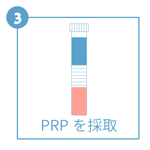 PRPの手順３PRPを採取